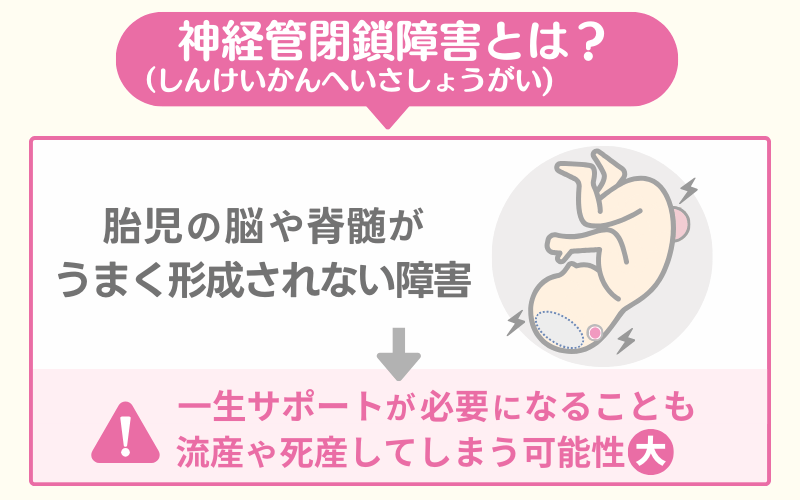 神経管閉鎖障害