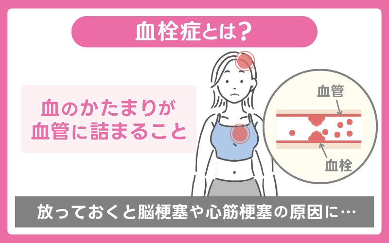 血栓症の副作用に気づきにくいから