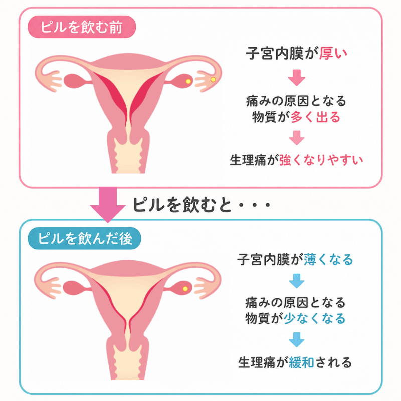 ピルで生理痛が緩和する仕組み