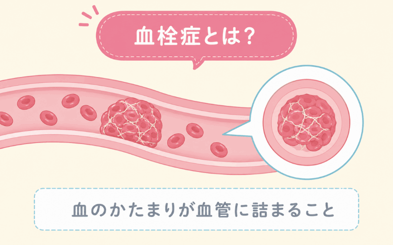 ピルの副作用血栓症とは