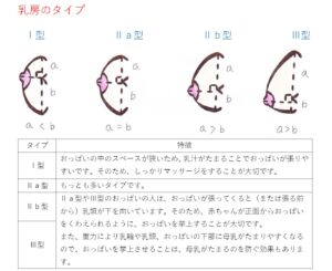 乳房のタイプ